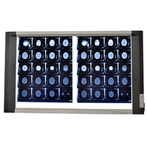 x-ray-viewer-two-screen-310×310